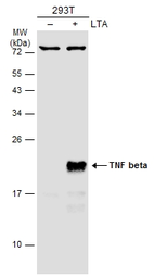 Anti-TNF beta antibody used in Western Blot (WB). GTX130100