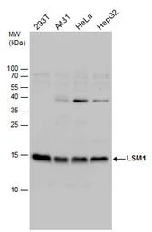 Anti-LSM1 antibody used in Western Blot (WB). GTX130104