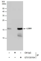 Anti-LSM1 antibody used in Immunoprecipitation (IP). GTX130104
