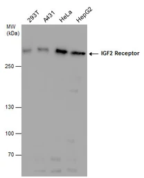 Anti-IGF2R antibody used in Western Blot (WB). GTX130109
