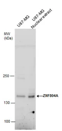 Anti-ZNF804A antibody used in Western Blot (WB). GTX130124