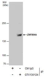 Anti-ZNF804A antibody used in Immunoprecipitation (IP). GTX130124