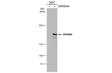 Anti-ZNF804A antibody used in Western Blot (WB). GTX130124