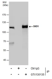 Anti-SND1 antibody used in Immunoprecipitation (IP). GTX130135