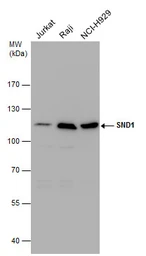 Anti-SND1 antibody used in Western Blot (WB). GTX130136