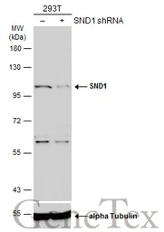 Anti-SND1 antibody used in Western Blot (WB). GTX130136