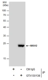Anti-MIS12 antibody used in Immunoprecipitation (IP). GTX130138