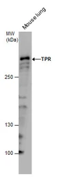 Anti-TPR antibody used in Western Blot (WB). GTX130142