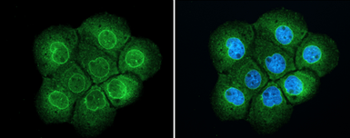 Anti-TPR antibody used in Immunocytochemistry/ Immunofluorescence (ICC/IF). GTX130142