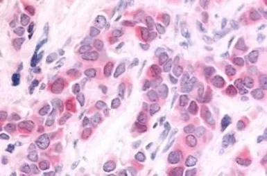 Anti-HUNK antibody used in IHC (Paraffin sections) (IHC-P). GTX13016