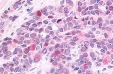Anti-HUNK antibody used in IHC (Paraffin sections) (IHC-P). GTX13016
