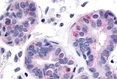 Anti-HUNK antibody used in IHC (Paraffin sections) (IHC-P). GTX13016