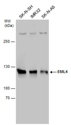Anti-EML4 antibody used in Western Blot (WB). GTX130169