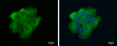 Anti-VPS18 antibody used in Immunocytochemistry/ Immunofluorescence (ICC/IF). GTX130176