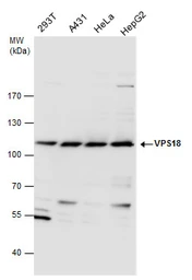 Anti-VPS18 antibody used in Western Blot (WB). GTX130176