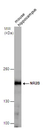 Anti-NMDAR2B antibody used in Western Blot (WB). GTX130184
