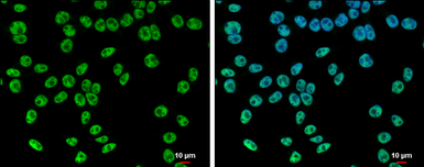 Anti-SETD1A antibody used in Immunocytochemistry/ Immunofluorescence (ICC/IF). GTX130194