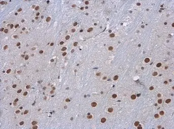 Anti-SETD1A antibody used in IHC (Paraffin sections) (IHC-P). GTX130194