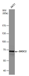 Anti-SHOC2 antibody used in Western Blot (WB). GTX130206