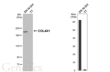 Anti-COL4A1 antibody used in Western Blot (WB). GTX130215