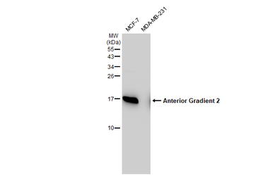 Anti-Anterior Gradient 2 antibody used in Western Blot (WB). GTX130229