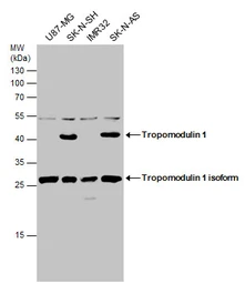 Anti-Tropomodulin 1 antibody used in Western Blot (WB). GTX130237
