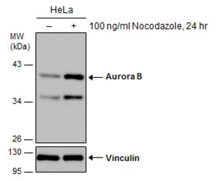 Anti-Aurora B antibody used in Western Blot (WB). GTX130238