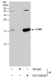 Anti-LSM1 antibody used in Immunoprecipitation (IP). GTX130240