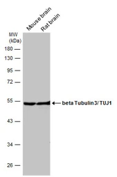 Anti-beta Tubulin 3/ Tuj1 antibody used in Western Blot (WB). GTX130245