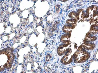 Anti-DOCK8 antibody used in IHC (Paraffin sections) (IHC-P). GTX130251
