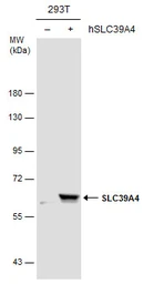 Anti-SLC39A4 antibody used in Western Blot (WB). GTX130285