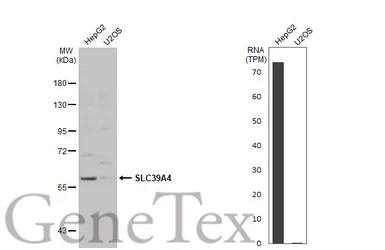 Anti-SLC39A4 antibody used in Western Blot (WB). GTX130285