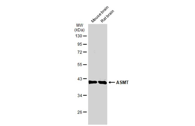 Anti-ASMT antibody used in Western Blot (WB). GTX130292