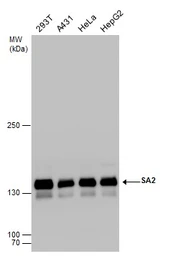 Anti-SA2 antibody used in Western Blot (WB). GTX130298
