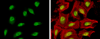 Anti-SA2 antibody used in Immunocytochemistry/ Immunofluorescence (ICC/IF). GTX130299