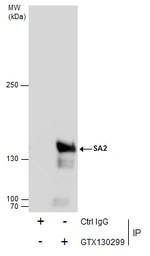 Anti-SA2 antibody used in Immunoprecipitation (IP). GTX130299