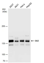 Anti-SA2 antibody used in Western Blot (WB). GTX130299