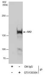 Anti-SA2 antibody used in Immunoprecipitation (IP). GTX130304