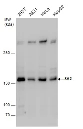 Anti-SA2 antibody used in Western Blot (WB). GTX130304