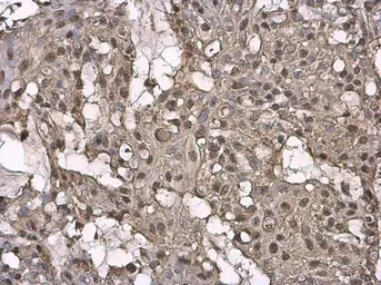 Anti-SA2 antibody used in IHC (Paraffin sections) (IHC-P). GTX130304