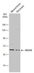 Anti-RGS14 antibody used in Western Blot (WB). GTX130309