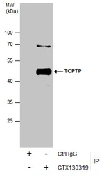 Anti-TCPTP antibody used in Immunoprecipitation (IP). GTX130319