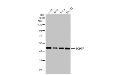 Anti-TCPTP antibody used in Western Blot (WB). GTX130319