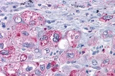 Anti-MAS1 antibody used in IHC (Paraffin sections) (IHC-P). GTX13032