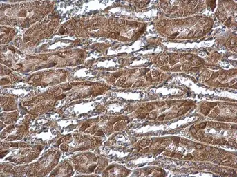 Anti-MTCH2 antibody used in IHC (Paraffin sections) (IHC-P). GTX130324