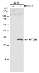 Anti-MTCH2 antibody used in Western Blot (WB). GTX130324