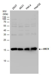 Anti-UBE2I antibody used in Western Blot (WB). GTX130355