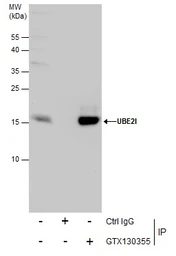 Anti-UBE2I antibody used in Immunoprecipitation (IP). GTX130355