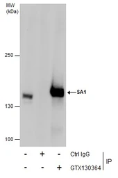 Anti-SA1 antibody used in Immunoprecipitation (IP). GTX130364