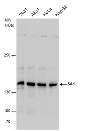 Anti-SA1 antibody used in Western Blot (WB). GTX130364